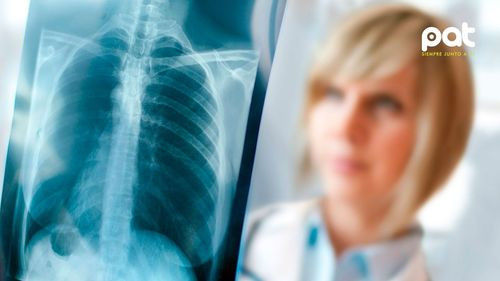Investigación internacional mejora el diagnóstico temprano de neumonía grave en menores