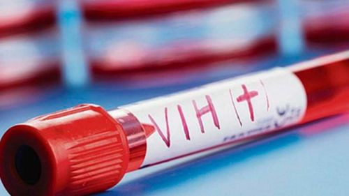 Autoridades de salud alertan sobre  incremento de transmisiones de  VIH/SIDA en el Beni