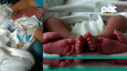 Nacen trillizos y la familia pide ayuda ante desafíos económicos