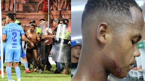 Bolívar y Guabirá terminan a golpes el amistoso en Montero