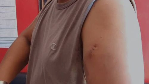 Montero: Hombre denuncia a su expareja por agresión e intento de homicidio