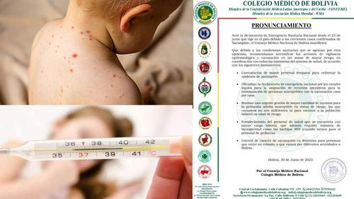  Consejo Médico Nacional pide intensificar vacunación y vigilancia ante emergencia sanitaria por sarampión