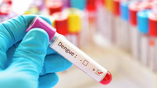 Test de dengue y su disponibilidad en medio del pico epidémico
