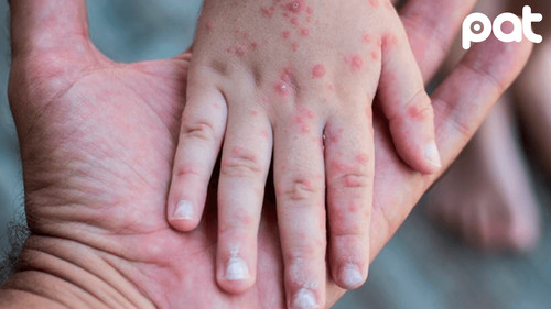 Bolivia en riesgo de perder certificaciones de salud