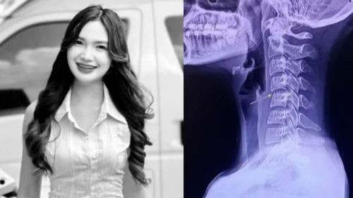 Cantante tailandesa falleció tras un masaje: los riesgos detrás de las torsiones cervicales