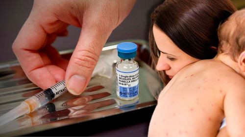 EE.UU. registra récord de casos de sarampión desde el año 2000