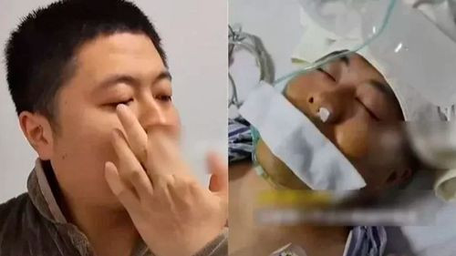Hábito peligroso: Hombre es operado de emergencia por hurgarse la nariz
